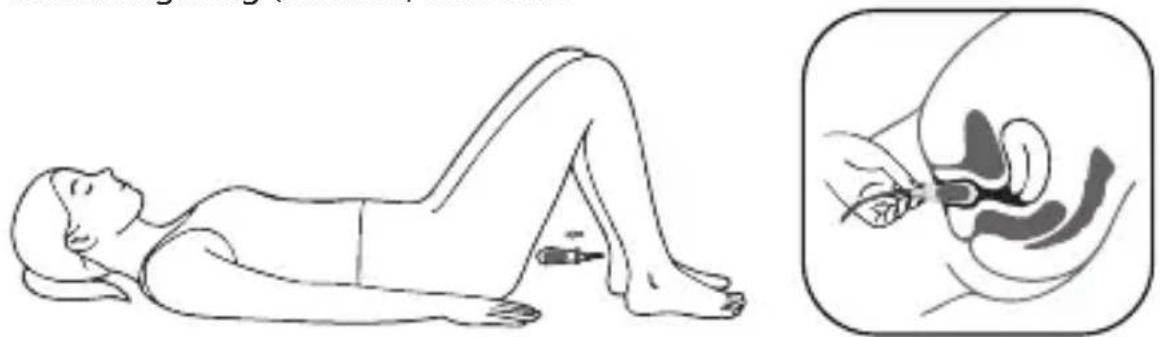 Luvion Pelvic Floor Trainer - Beckenbodentraining mit der Vaginalsonde - 1