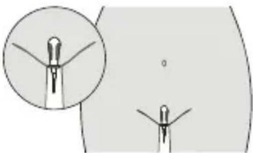 Luvion Pelvic Floor Trainer - Pelvic Floor Training using the Vaginal Probe - 2