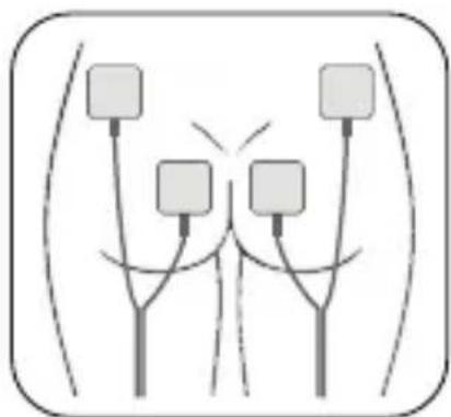 Luvion Pelvic Floor Trainer - Electrode Pads Placement - 5