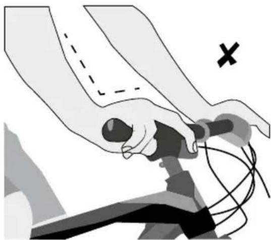 Urban Arrow Breeze - Blessures - 4