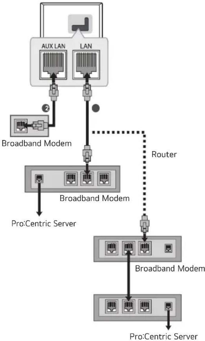 LG 65UK570H0UD - Wired network connection - 1