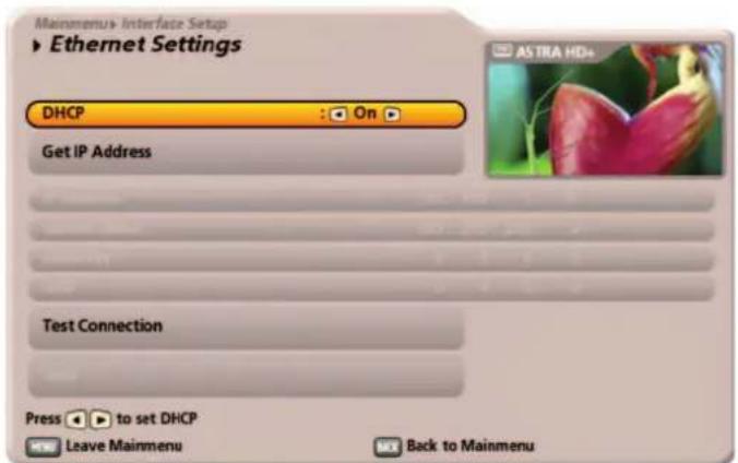 KATHREIN UFS 922sw - DHCP "Off" (Hub/Switch/Direct connection to PC or laptop) - 1