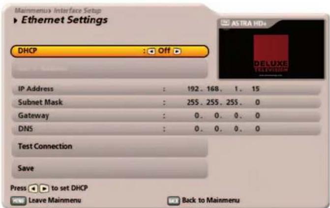KATHREIN UFS 922sw - DHCP "Off" (Hub/Switch/Direct connection to PC or laptop) - 2