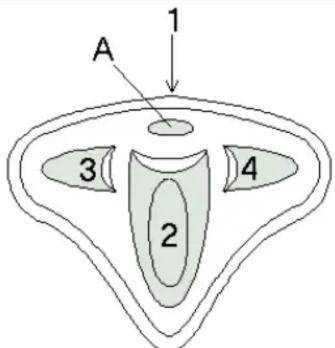 A 1 3 2 4