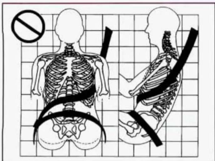 Medical illustration showing human skeletal anatomy with a no-smoking symbol and a grid background