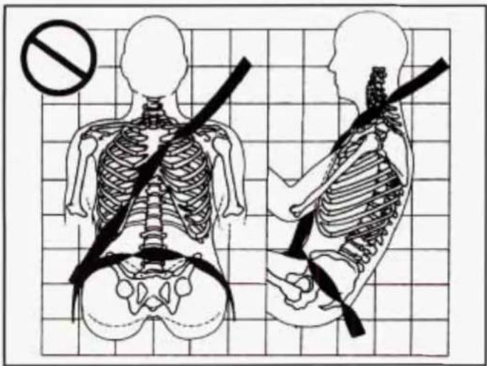 Medical illustration showing human skeleton with a no-smoking symbol and corresponding side views of the same skeletal structure.