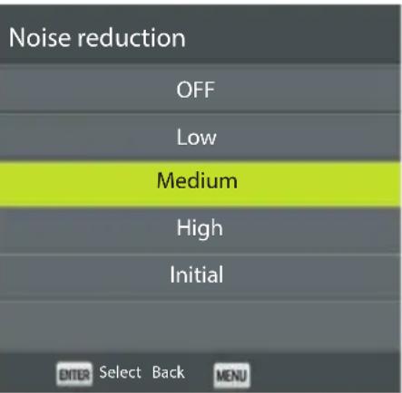 ECG 32 H04T2S2 - Noise reduction - 1