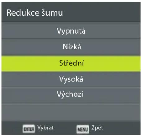 ECG 32 H04T2S2 - Redukce šumu - 1