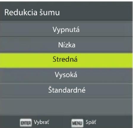 ECG 32 H04T2S2 - Redukcia šumu - 1