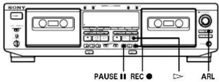 SONY TC-WE605S - Adjusting the Recording Level Automatically (Auto Rec Level) - 1