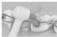 PANASONIC EW1313 - Para la zona de brackets de ortodoncia - 1
