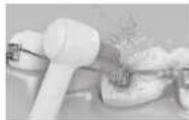 PANASONIC EW1313 - ▶ Pour la zone du bracket orthodontique - 1