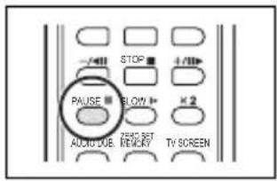 CANON MVX350i - Press the PAUSE button on the wireless controller to begin dubbing. - 1