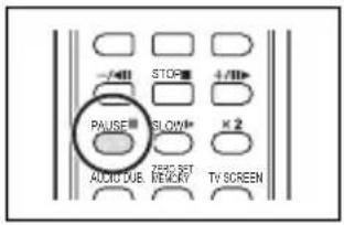 CANON MVX330i - Press the PAUSE button on the wireless controller to begin dubbing. - 1