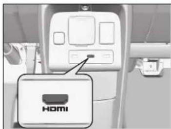 HOMI
