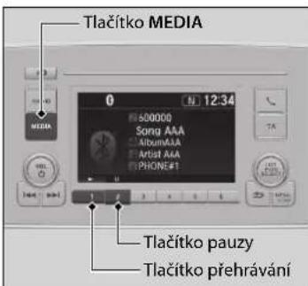 Tlačítko MEDIA 0 N 12:34 600000 Song AAA AlbumAAA Artist AAA PHONE#1 Tlačítko pauzy Tlačítko přehrávání