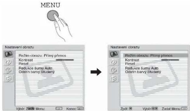 MENU Nastaveni obrazu Režim obrazu: Prímy přenos Kontrast Reset Reducekce šumu Auto Odstin barvy Studeny Výběr Záříň Menu: Konec Servi Nastaveni obrazu Režim obrazu: Prímy přenos Kontrast Reset Reducekce šumu Auto Odstin barvy Studeny Zpět: Výběr Zadat Menu: