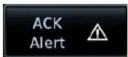 GARMIN G700 TXi - ACK Alert UNACK Alert - 1
