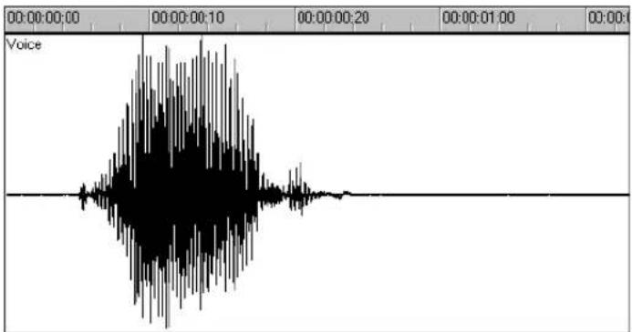 Voice 00:00:00:00 00:00:00:10 00:00:00:20 00:00:01:00 00:00:01