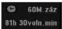 LG RH7823CP1L - Záznam s okamžitým časovačem - 1