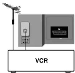 VCR