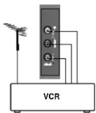 VCR