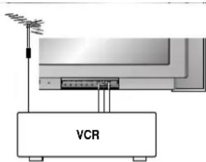 VCR