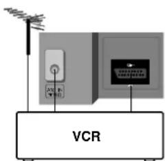 VCR
