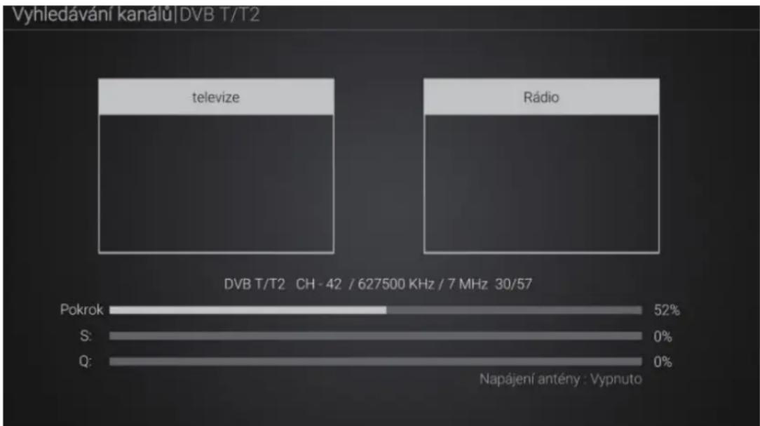 TESLA MediaBox XT650 - Symbol DTV s obrazovkou: - 5