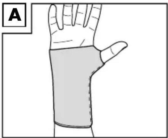 Sensiplast IAN 102523 - Applying the brace - 1