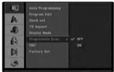 LG LH-R7500TA - Progressive Scan - 1