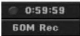 LG LH-R7500TA - Instant Timer Recording - 1