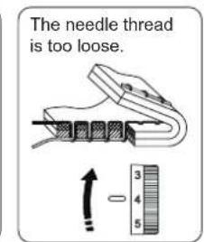 The needle thread is too loose.