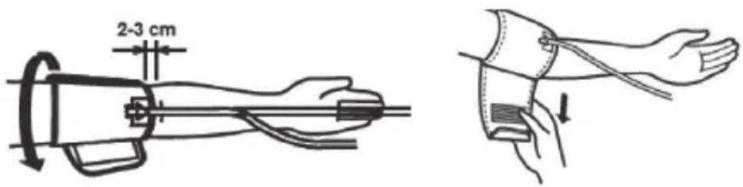 2-3 cm