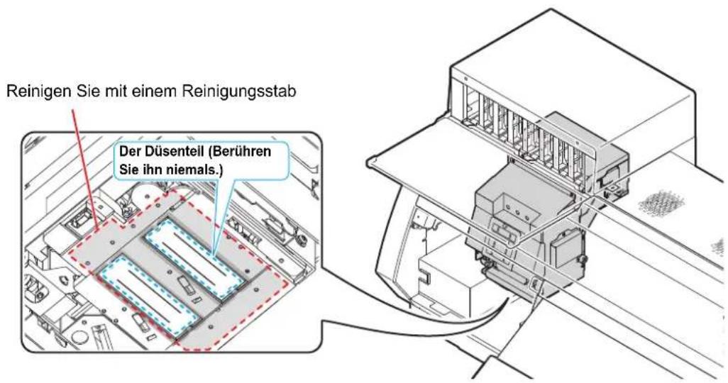 Reinigen Sie mit einem Reinigungsstab Der Düsentell (Berühren Sie ihn niemals.)