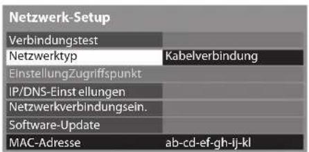 PANASONIC TX-P46ST30E - Wählen Sie [Netzwerktyp] und stellen Sie auf [Kabelverbindung] ein - 1