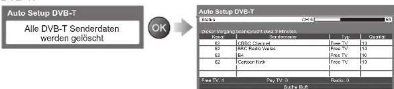 PANASONIC TX-P42U20E - Starten Sie die automatische Senderabstimmung. - 1