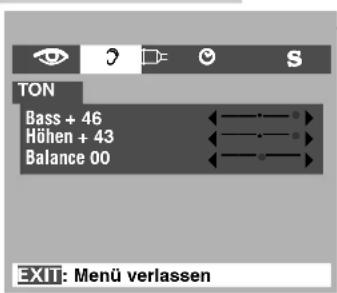 GRUNDIG ACCORO 102 MFW 102-6110 MV/AC3 - Interne Bassverstärkung verändern - 1