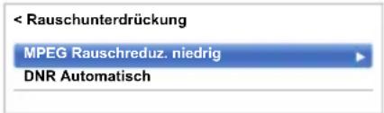 TOSHIBA 58M9363 - MPEG Rauschreduz. – Rauschunterdrückung - 1