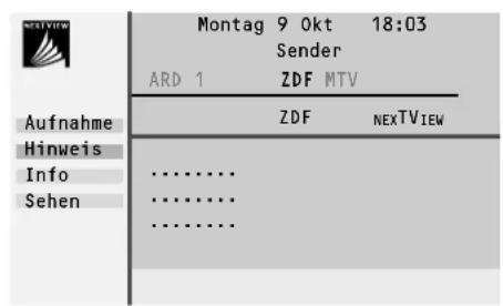 PHILIPS 28PW9525 - Menü - 2