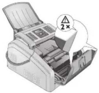 PHILIPS Laserfax LPF 5120 - Kanten am Gerätedeckel! - 1