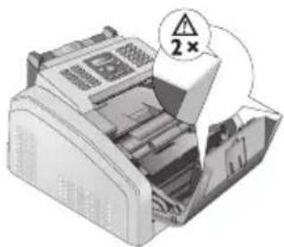 PHILIPS Laserfax LPF 5120 - Kanten am Gerätedeckel! - 1