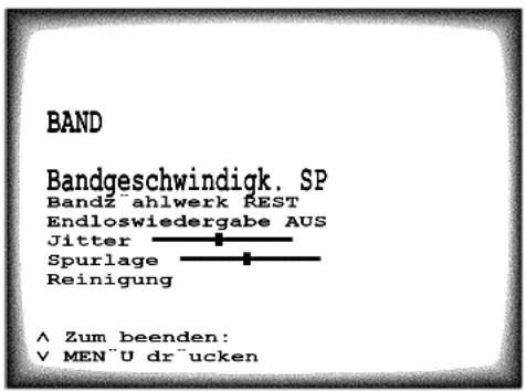 PHILIPS Blackline 21PV330 - Endlose Wiedergabe einer Kassette - 1