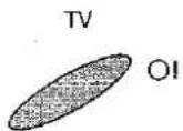 SHARP 51ET-35S - De TV aanzetten - 1