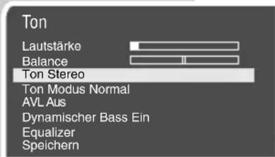 GRUNDIG Arcance 72 Flat MF 72-2502-8 TOP - Ton-Einstellungen - 7