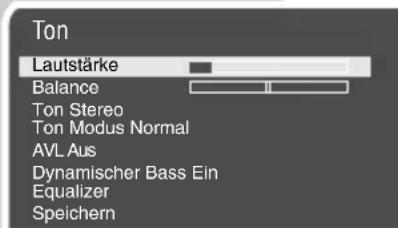GRUNDIG Arcance 72 Flat MF 72-2502-8 TOP - Ton-Einstellungen - 1