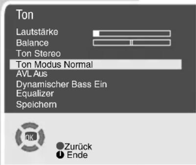 GRUNDIG Arcance 72 Flat MF 72-2502-8 TOP - Stereo-/Zweiton, Mono - 1