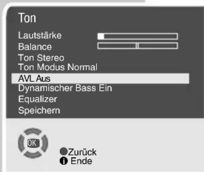 GRUNDIG Arcance 72 Flat MF 72-2502-8 TOP - Stereo-/Zweiton, Mono - 2