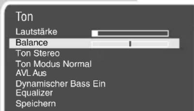 GRUNDIG Arcance 72 Flat MF 72-2502-8 TOP - Ton-Einstellungen - 5