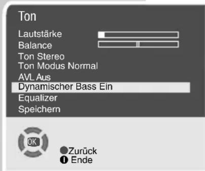 GRUNDIG Arcance 72 Flat MF 72-2502-8 TOP - Stereo-/Zweiton, Mono - 3